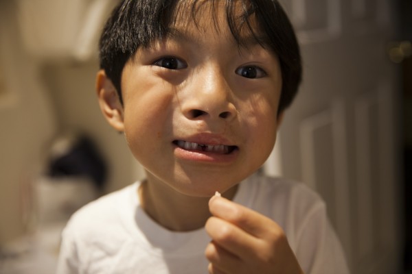 2015.6.22 - Tooth